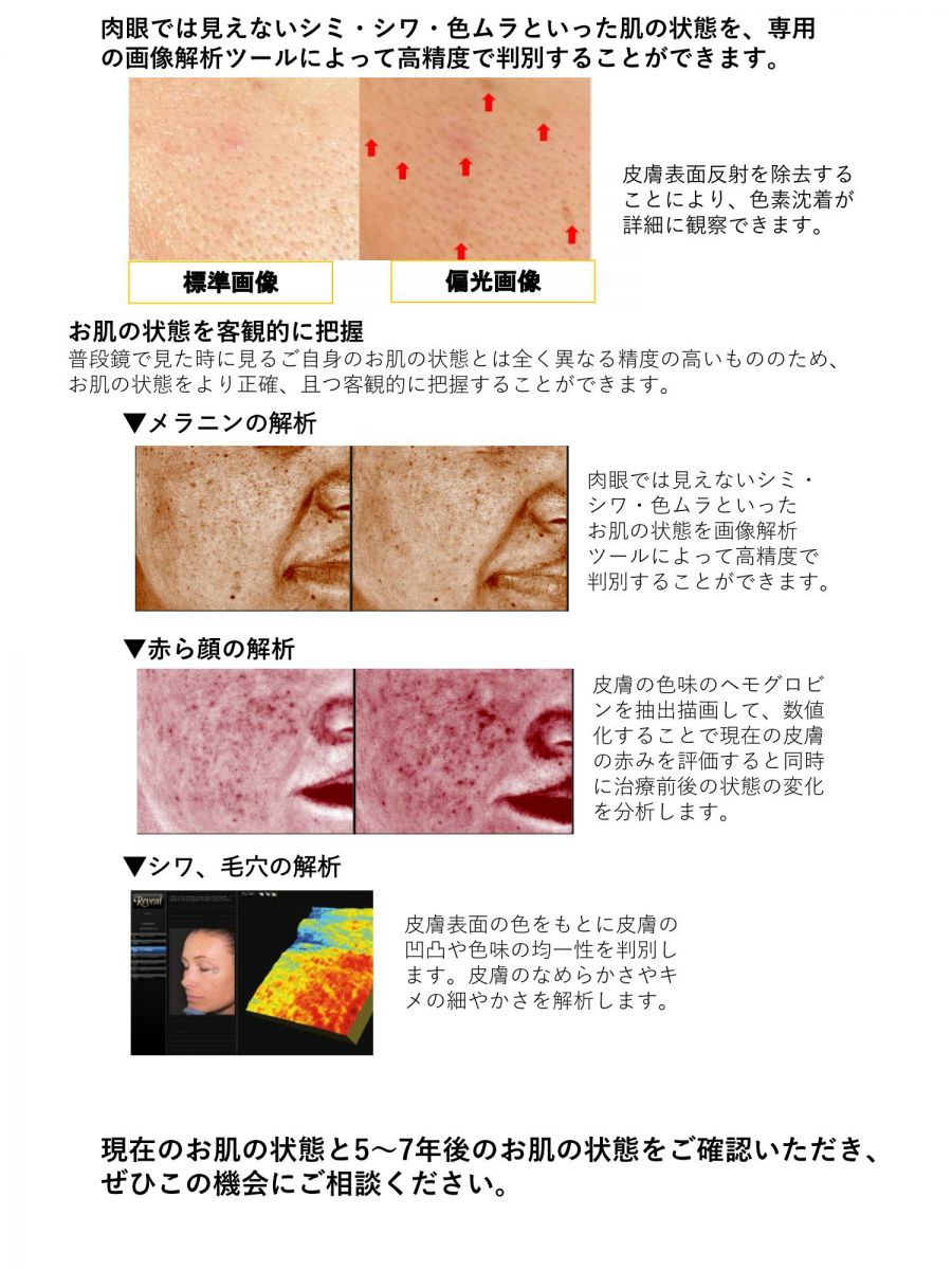 5～7年後のお肌の状態が分かります!最新肌画像診断カメラ導入 | 精美スキンケアクリニック｜美容皮膚科・美容外科